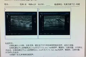 体检发现乳腺结节怎么办？图片