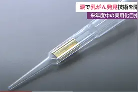 乳腺癌检测新技术：采集泪水后　20分钟出结果图片