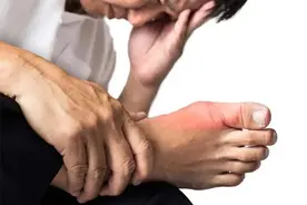 导致痛风发作的诱因，常见的有哪些，能够预防吗？医生为您讲清楚图片