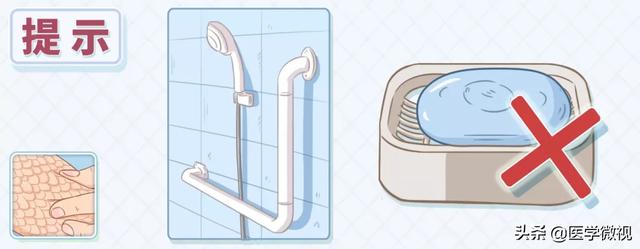 我的x性连锁鱼鳞病经历 我的x性连锁鱼鳞病经历