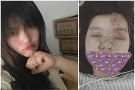 悲剧！滑县妙龄女子微整形致眼睛失明！这种“小手术”好多人都在做......图片