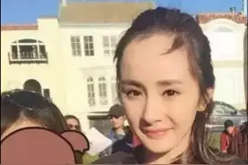 娜扎“凡尔赛式”炫发际线，暴露了明星们除身高体重外的另一无奈图片