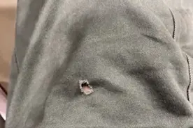 两次被暴徒扔腐蚀性液体灼伤，香港女警仍称：能救一个是一个图片