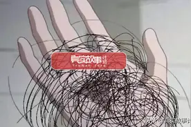 故事：花上万元植发，三十岁辞职生发？脱发，当代年轻人逃不过的苦海图片