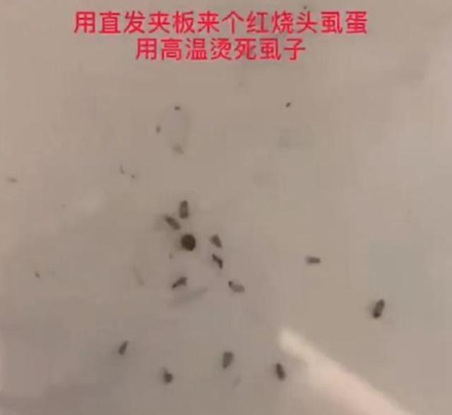 女儿头上长了许多虱子，宝妈用热夹板把头发烫了烫，结果很舒适