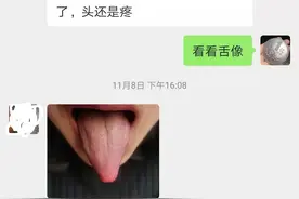 黄连上清丸：嗓子痛，脖子痛，头痛，牙龈痛图片