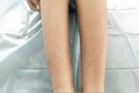 为什么有的女性体毛旺盛，有的“光秃秃”？哪类人体质更好？图片