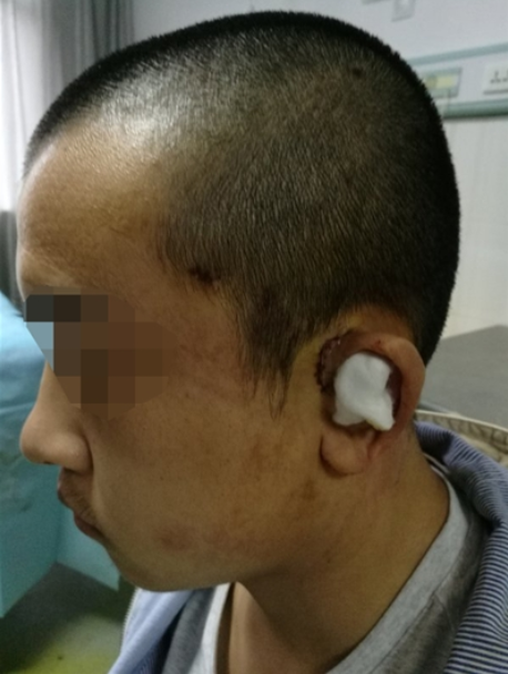 孩子叛逆矫正培训有用吗(图1)