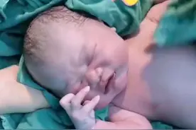 同样都是新生儿，头发疏密却大不同，4招教你解决孩子“秃”烦恼图片