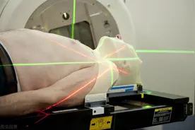 谈“放疗”色变？来听听医生怎么说图片