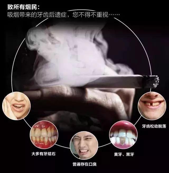 新西兰蜂胶 2026年新西兰蜂胶哪个品牌好