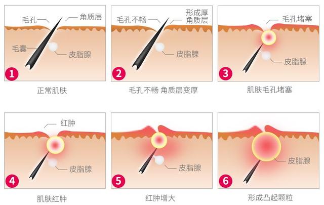 鸡皮肤霜一天抹几次