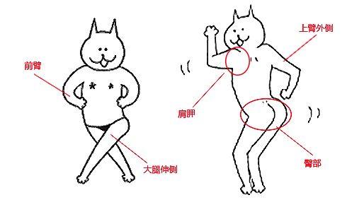 阿维a胶囊毛周角化症
