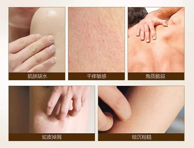 动物擦身体乳