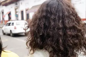 春天头皮敏感高发，如何做好防护？图片