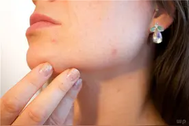 女人湿气重，要主动拒绝5类食物，多吃3物，祛湿排毒瘦出小蛮腰图片