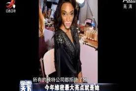 白癜风的模特 也能成为维密的最大亮点视频封面