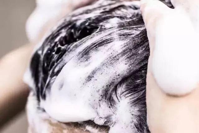 闆峰彅鏈夎揣涓ㄩ槻鑴辨皑鍩洪吀娲楀彂姘达紝澶寸毊鍋ュ悍涓嶆补鑵伙紝澶村彂钃澗瓒呴『婊? onerror=