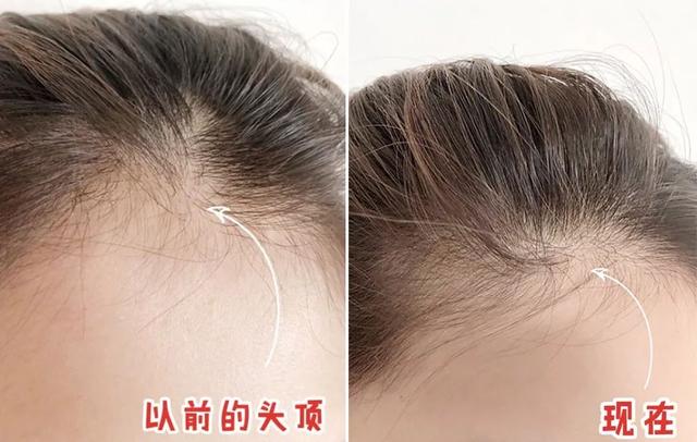 好物｜能防脱的氨基酸洗发水，洗完头发蓬松顺滑、两天都不油腻！