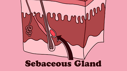 青春期皮肤角化