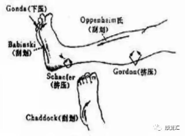 皮肤病手掌心角化裂隙能否对肌瘫瘫肌力鉴定