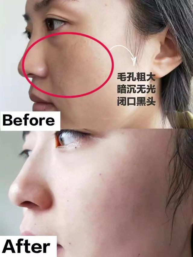 你的脸太脏了！这支“网红洗面奶”刷爆朋友圈，60秒让你彻底爱上洗脸！