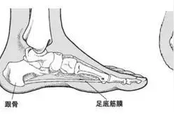 脚后跟总疼是怎么回事？图片