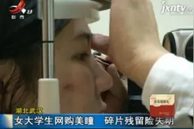 湖北武汉：女大学生网购美瞳 碎片残留险失明视频封面