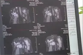 「提醒」皮肤瘙痒，竟暗藏肿瘤！这些可能是疾病信号，要警惕！图片