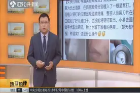 19岁女生为长出酒窝，竟让整容师在脸上打钢钉，结果“悲剧”了视频封面