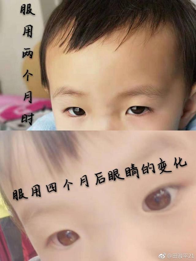 无极限保健品对儿童有没有副作用,效果好吗（心肌损害女童服用8款无限极产品1款不宜儿童）