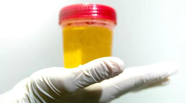 快撒泡尿！看看你的健康状况怎么样