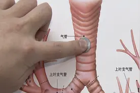 为了讨喜气，老人除夕夜吃下带硬币的饺子 不料呛入气管咳痰带血视频封面