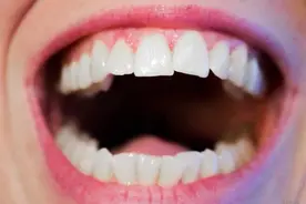 一嘴黄牙让你失去开口大笑的自信？来试试这几招，让你找回自信图片