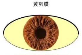 当你的眼睛出现这5大症状，快去查查自己的肝脏吧！图片