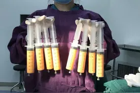 45岁中年妇女沉迷抽脂减肥，半年做了两次，最后住进加护病房图片