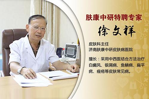 揪出斑秃6大致病原因 对斑秃说“NO”