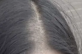 女子酒店睡一觉头发被剃，更可怕的是，监控里没人进过房间...视频封面