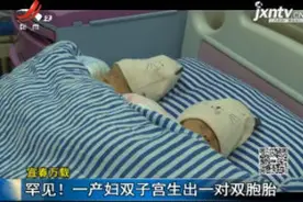 宜春万载：罕见！一产妇双子宫生出一对双胞胎视频封面