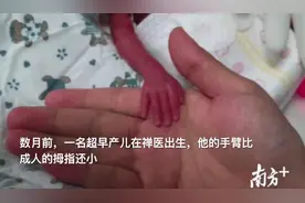 视频|佛山“迷你”男婴出生体重仅一斤多，手臂比成人拇指还小视频封面