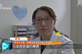 爱抠倒刺撕嘴皮？这是病，要治！它其实是特殊的心理强迫症视频封面
