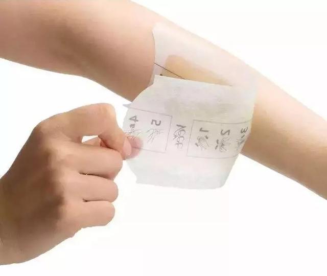 毛囊角化病可以用脱毛膏吗