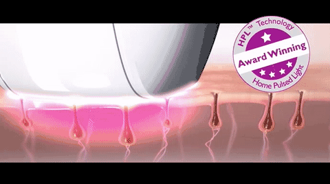 毛周角化能用家用冰点脱毛仪器吗