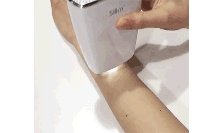 毛周角化能用家用冰点脱毛仪器吗