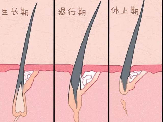 毛周角化能用家用冰点脱毛仪器吗