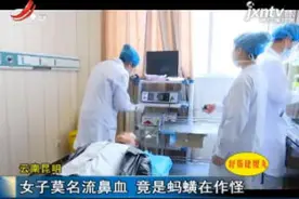 云南昆明：女子莫名流鼻血 竟是蚂蟥在作怪