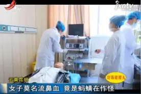 云南昆明：女子莫名流鼻血 竟是蚂蟥在作怪视频封面