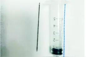 潍坊12岁男孩将缝衣针放入尿道，医生巧妙取出图片