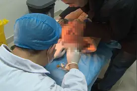 儿子经常大便出血，内裤上还总有血迹，爸爸仔细一看吓坏了！视频封面