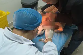 儿子经常大便出血，内裤上还总有血迹，爸爸仔细一看吓坏了！视频封面